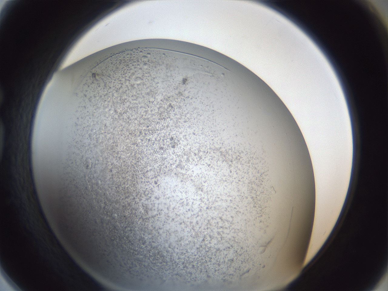 folderID966_plateID966_batchID1529_wellNum78_profileID1_d1_r37739_ef.jpg