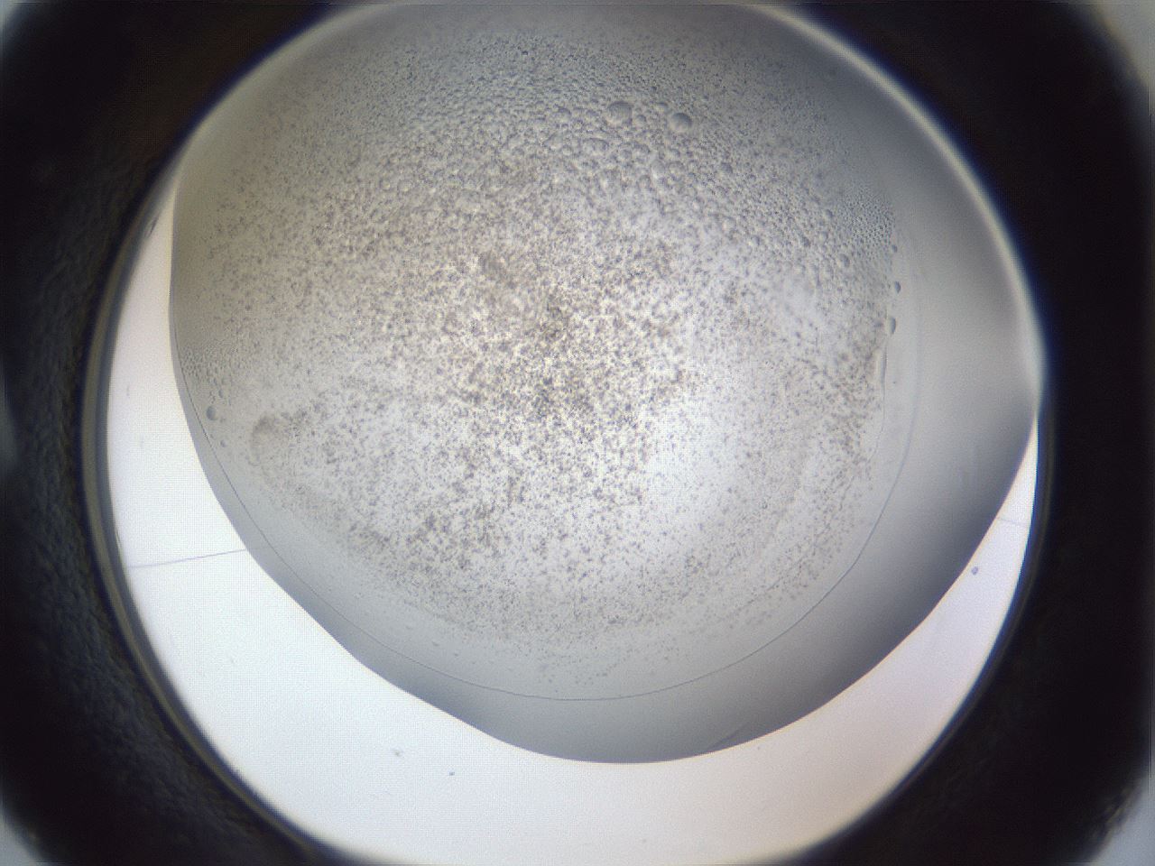 folderID966_plateID966_batchID1529_wellNum5_profileID1_d1_r37666_ef.jpg