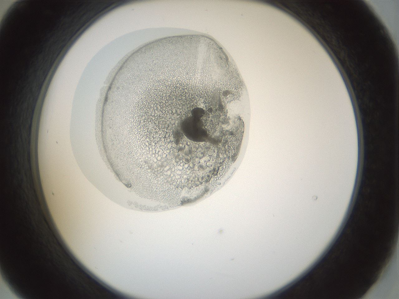 folderID986_plateID986_batchID1871_wellNum21_profileID1_d2_r39395_ef.jpg