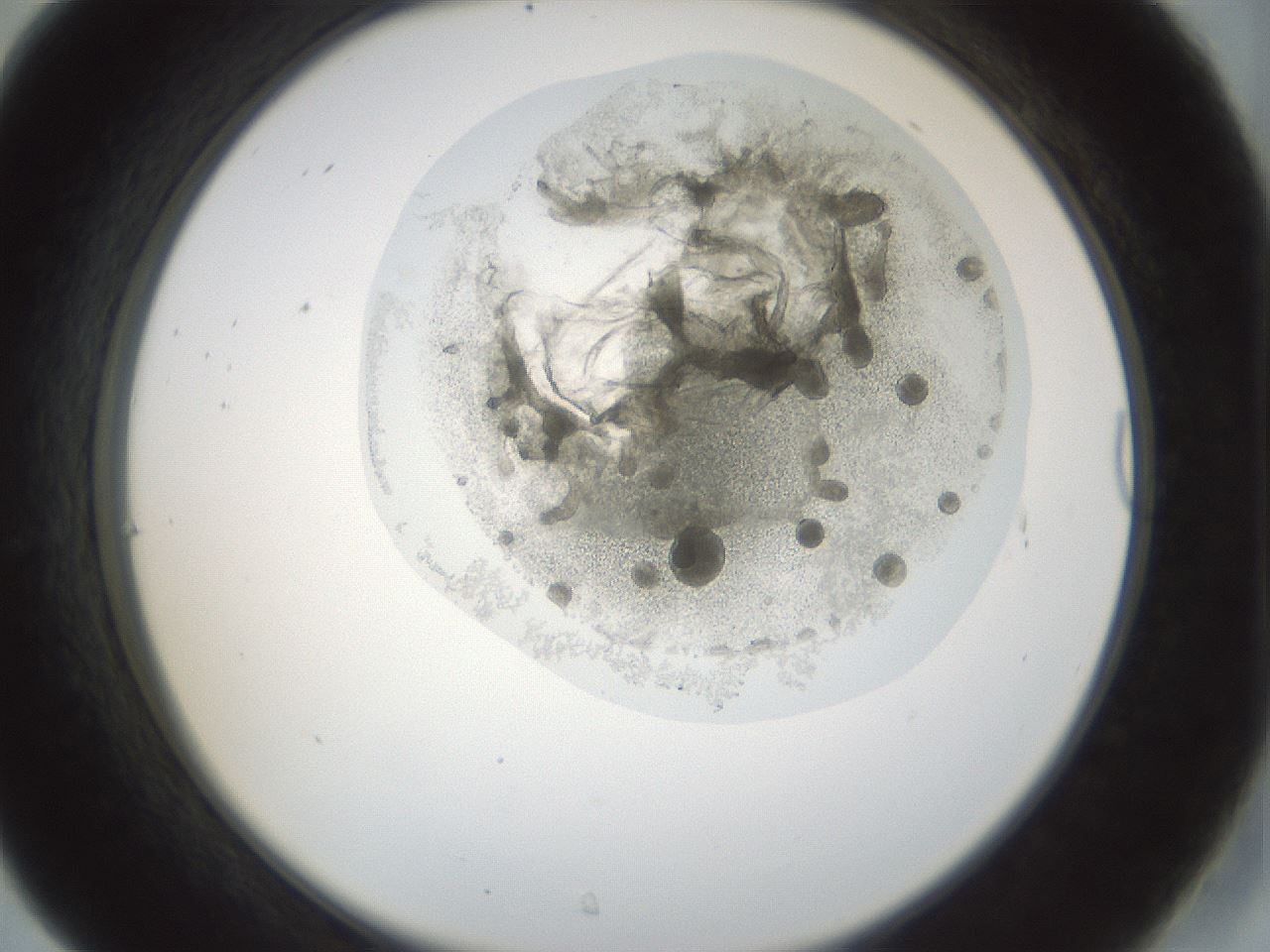 folderID987_plateID987_batchID1563_wellNum31_profileID1_d2_r40375_ef.jpg