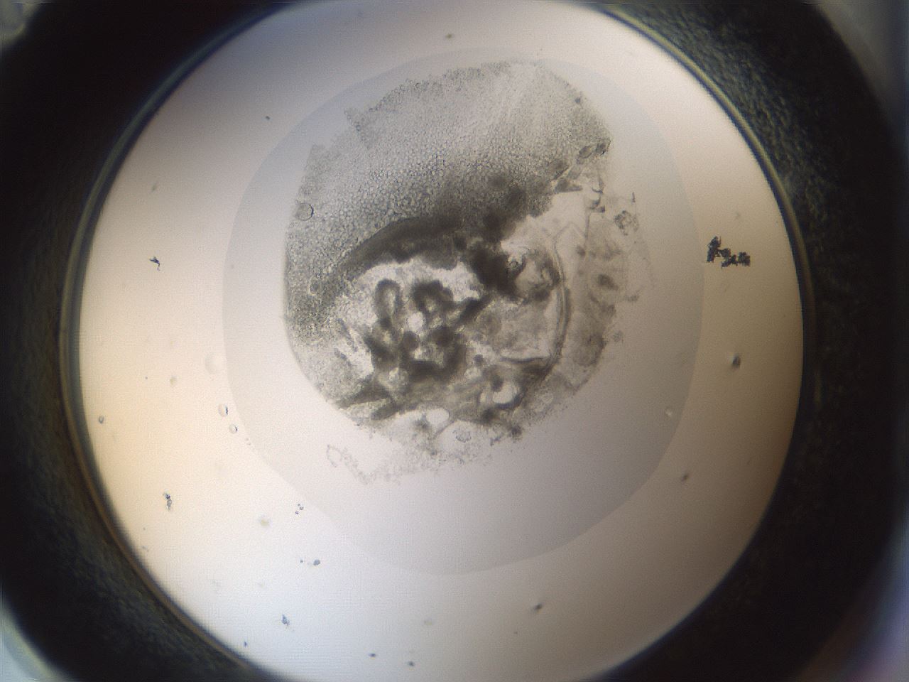 folderID987_plateID987_batchID1639_wellNum95_profileID1_d2_r40503_ef.jpg