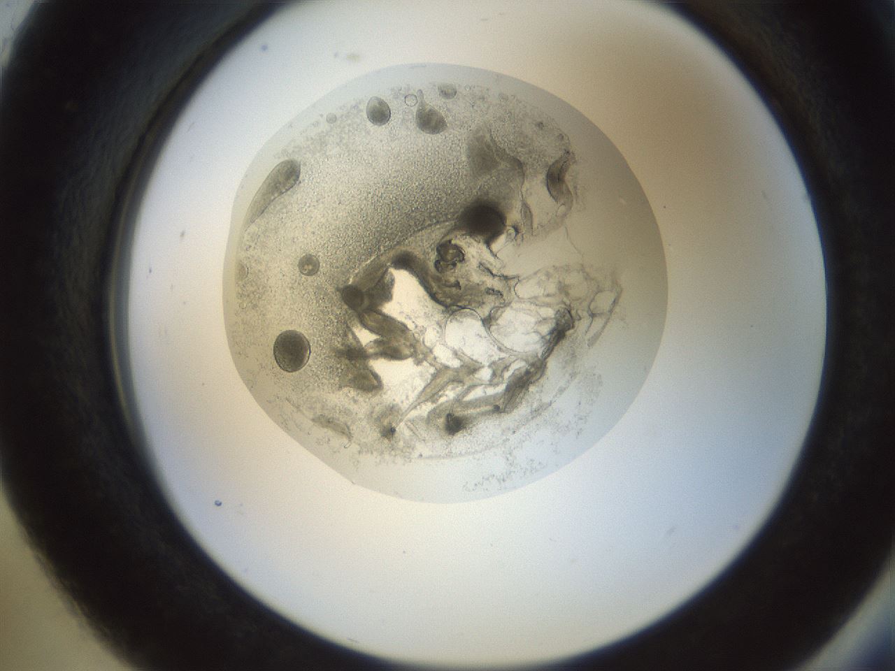 folderID990_plateID990_batchID1457_wellNum93_profileID1_d2_r39155_ef.jpg