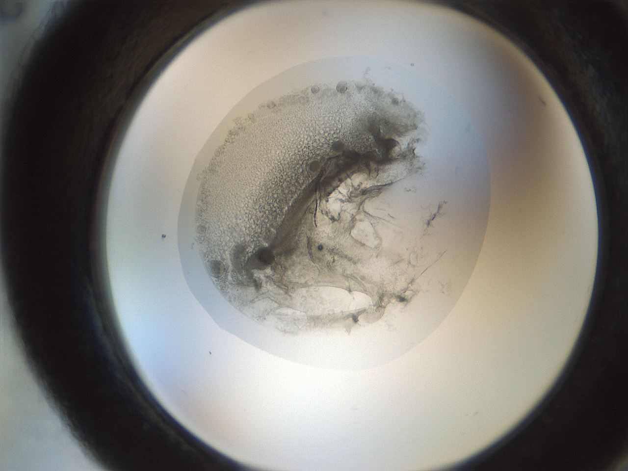 folderID990_plateID990_batchID1869_wellNum88_profileID1_d2_r39145_ef.jpg