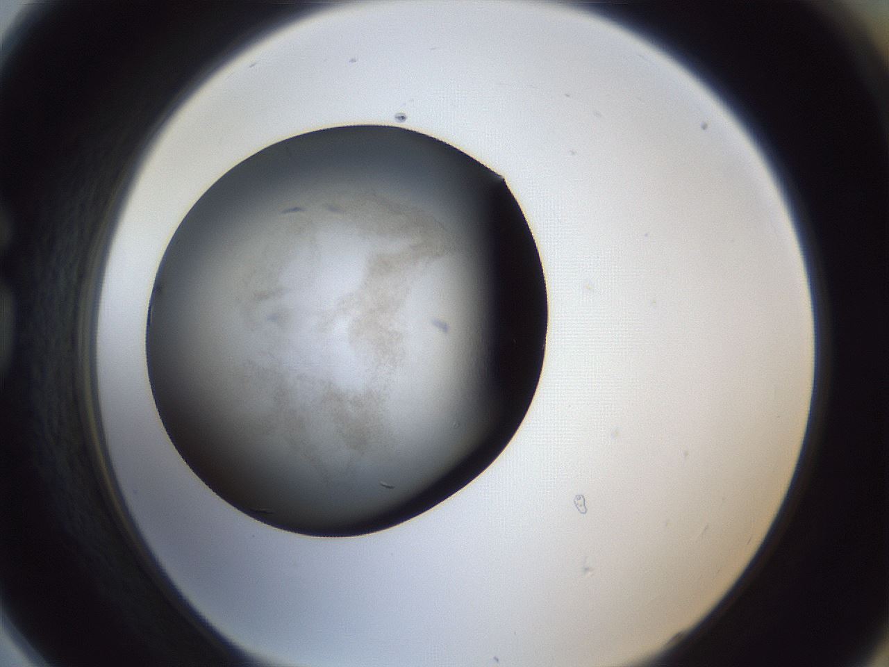 folderID119_plateID1119_batchID3515_wellNum78_profileID1_d1_r56611_ef.jpg