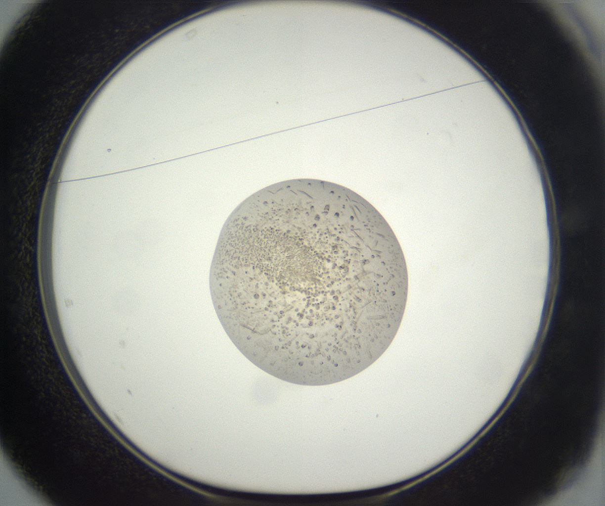 folderID381_plateID3381_batchID20593_wellNum37_profileID1_d1_r299223_ef.jpg