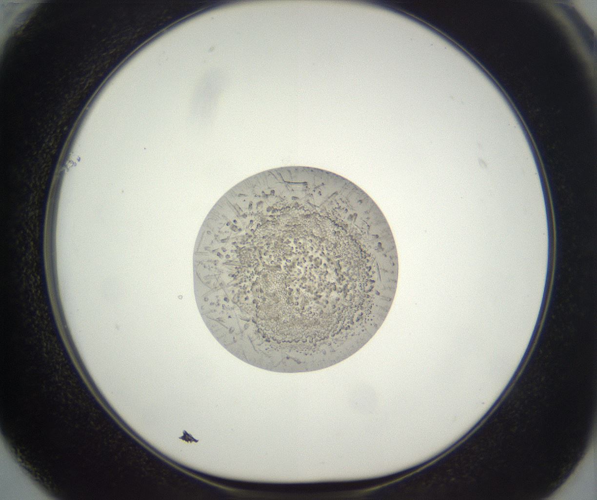 folderID396_plateID3396_batchID20677_wellNum61_profileID1_d1_r301551_ef.jpg