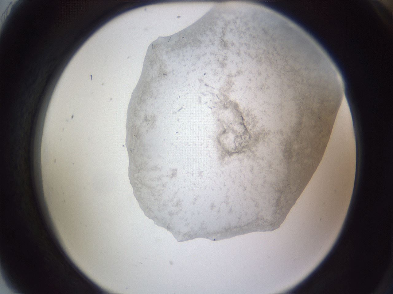 folderID407_plateID2407_batchID11550_wellNum91_profileID1_d2_r178904_ef.jpg