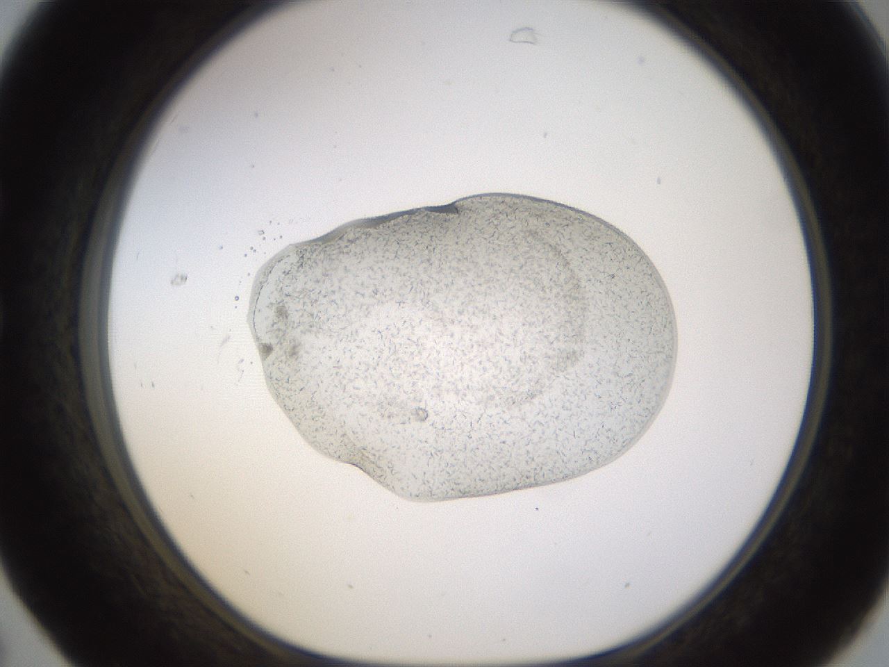folderID527_plateID1527_batchID5988_wellNum31_profileID1_d1_r98285_ef.jpg