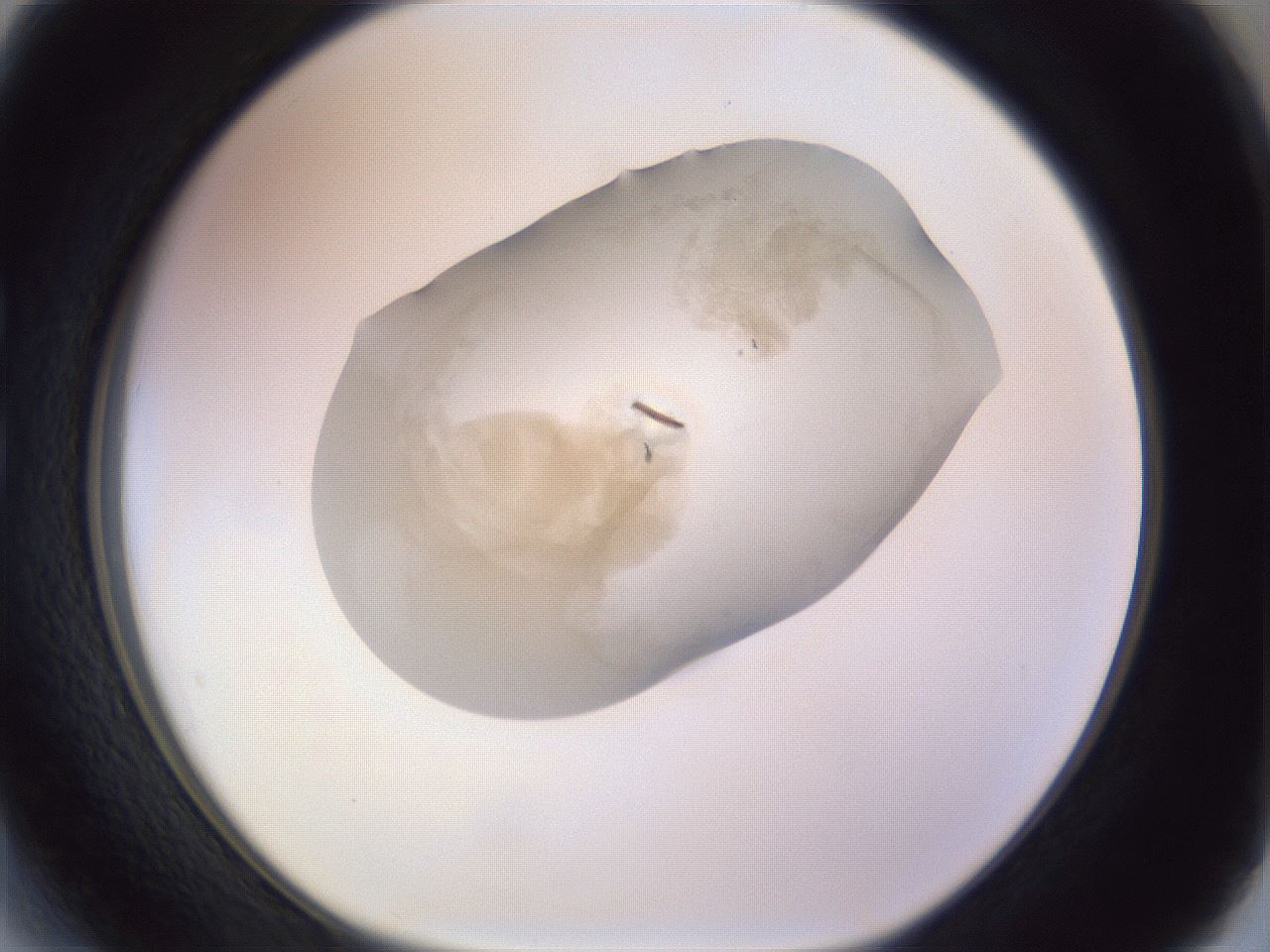 folderID978_plateID1978_batchID8612_wellNum27_profileID1_d1_r133386_ef.jpg