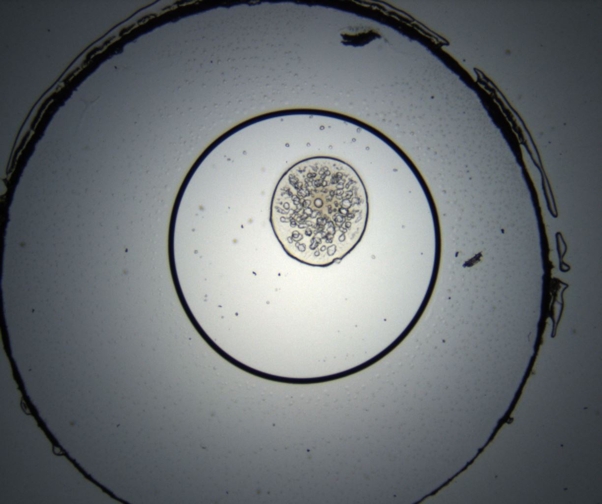 folderID37_plateID2037_batchID9233_wellNum21_profileID1_d1_r136855_ef.jpg