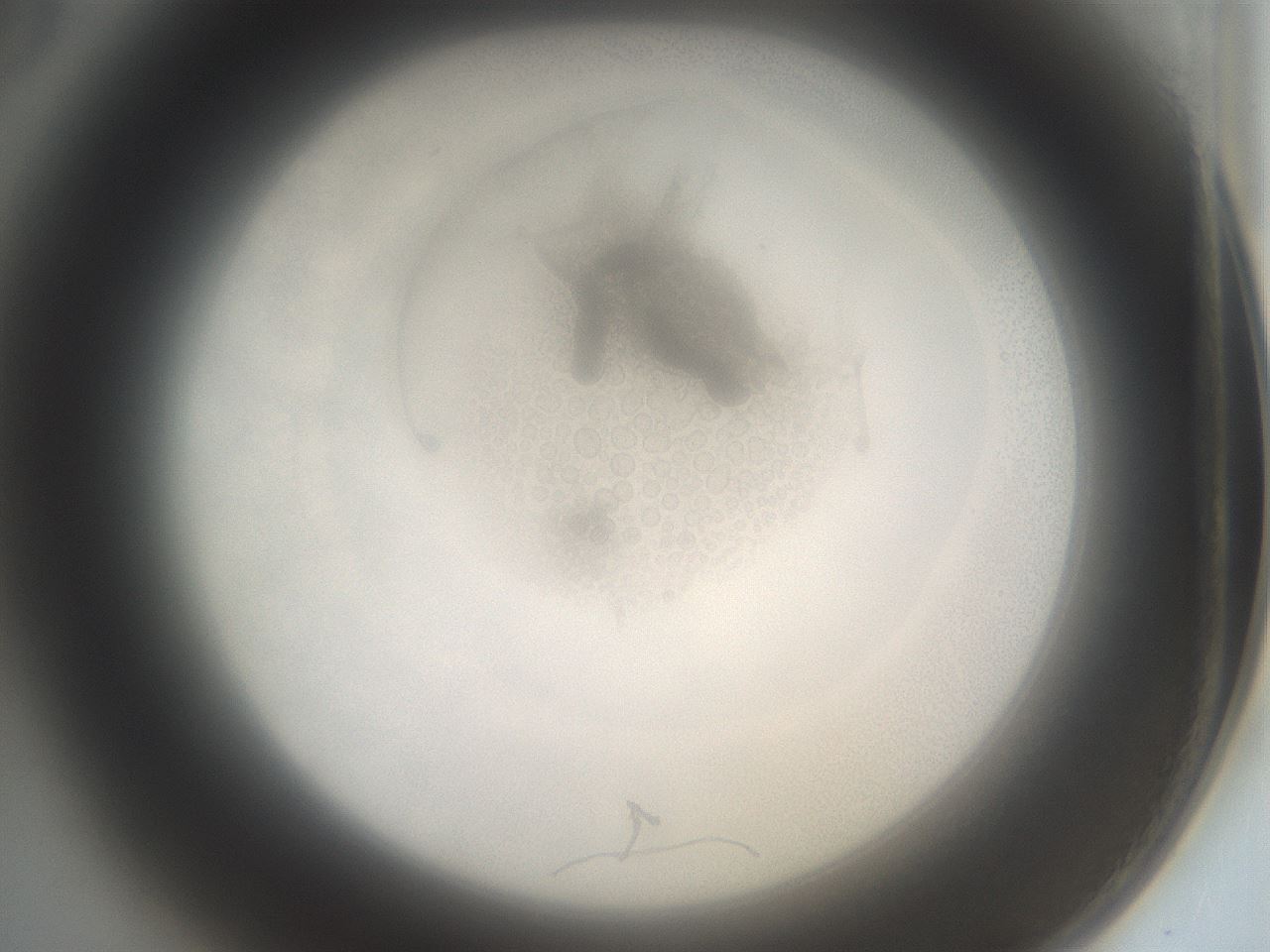 folderID865_plateID865_batchID1017_wellNum3_profileID1_d2_r29396_ef.jpg