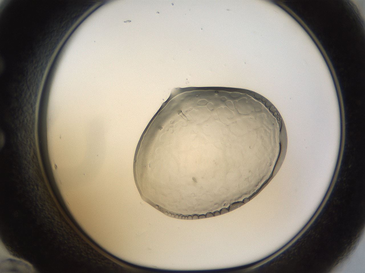 folderID935_plateID935_batchID1283_wellNum60_profileID1_d1_r34777_ef.jpg