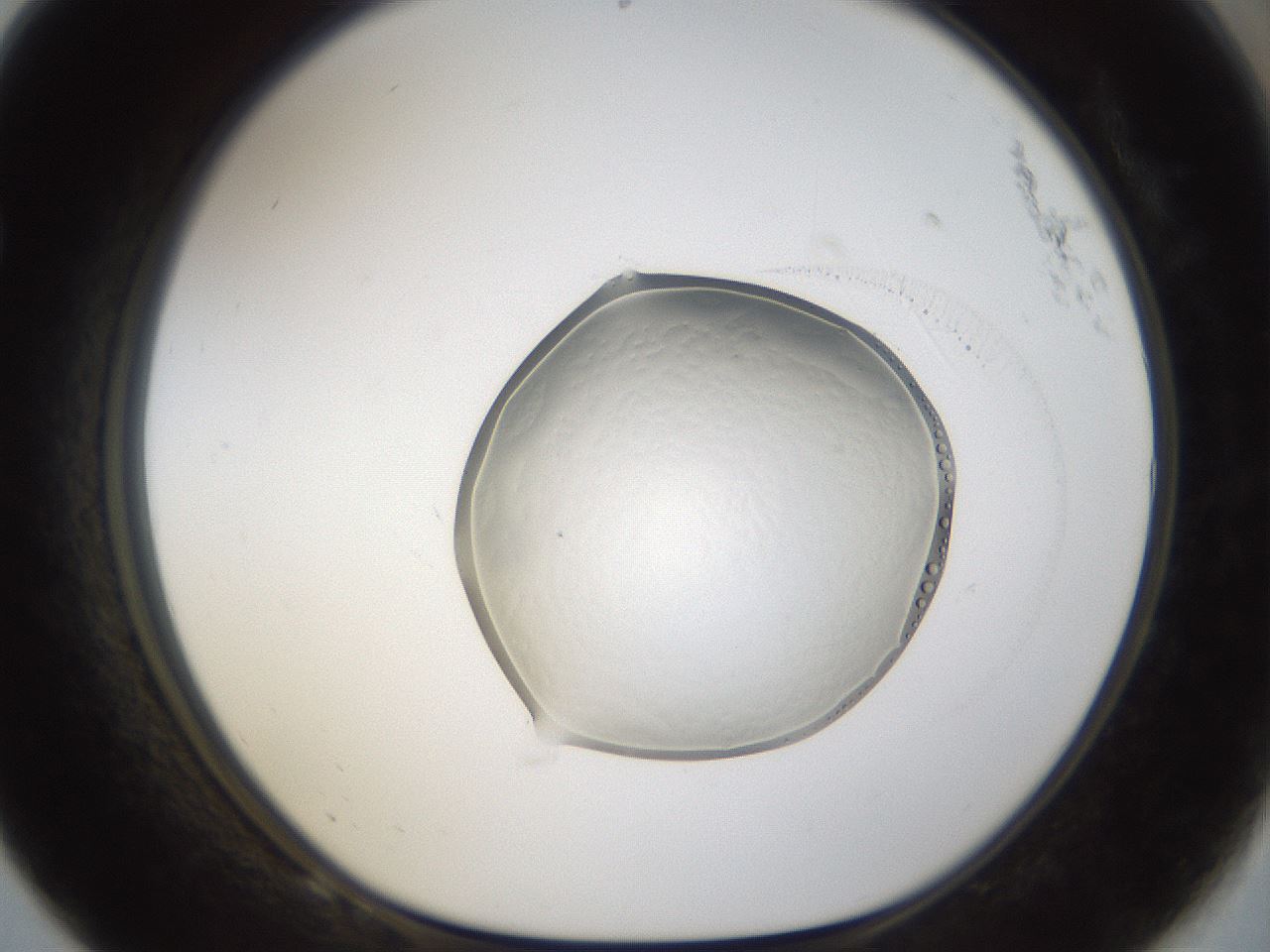 folderID935_plateID935_batchID1283_wellNum68_profileID1_d1_r34793_ef.jpg