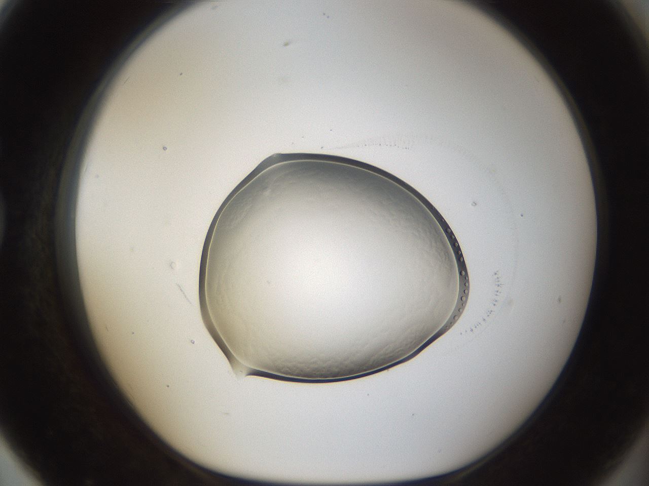folderID935_plateID935_batchID1283_wellNum79_profileID1_d1_r34815_ef.jpg