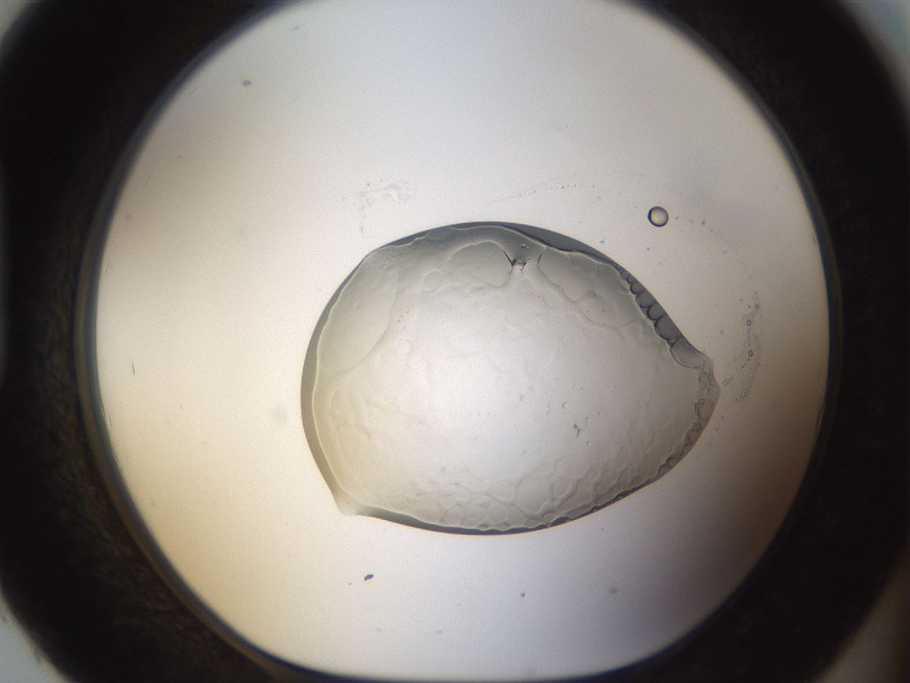 folderID935_plateID935_batchID1283_wellNum93_profileID1_d1_r34843_ef.jpg