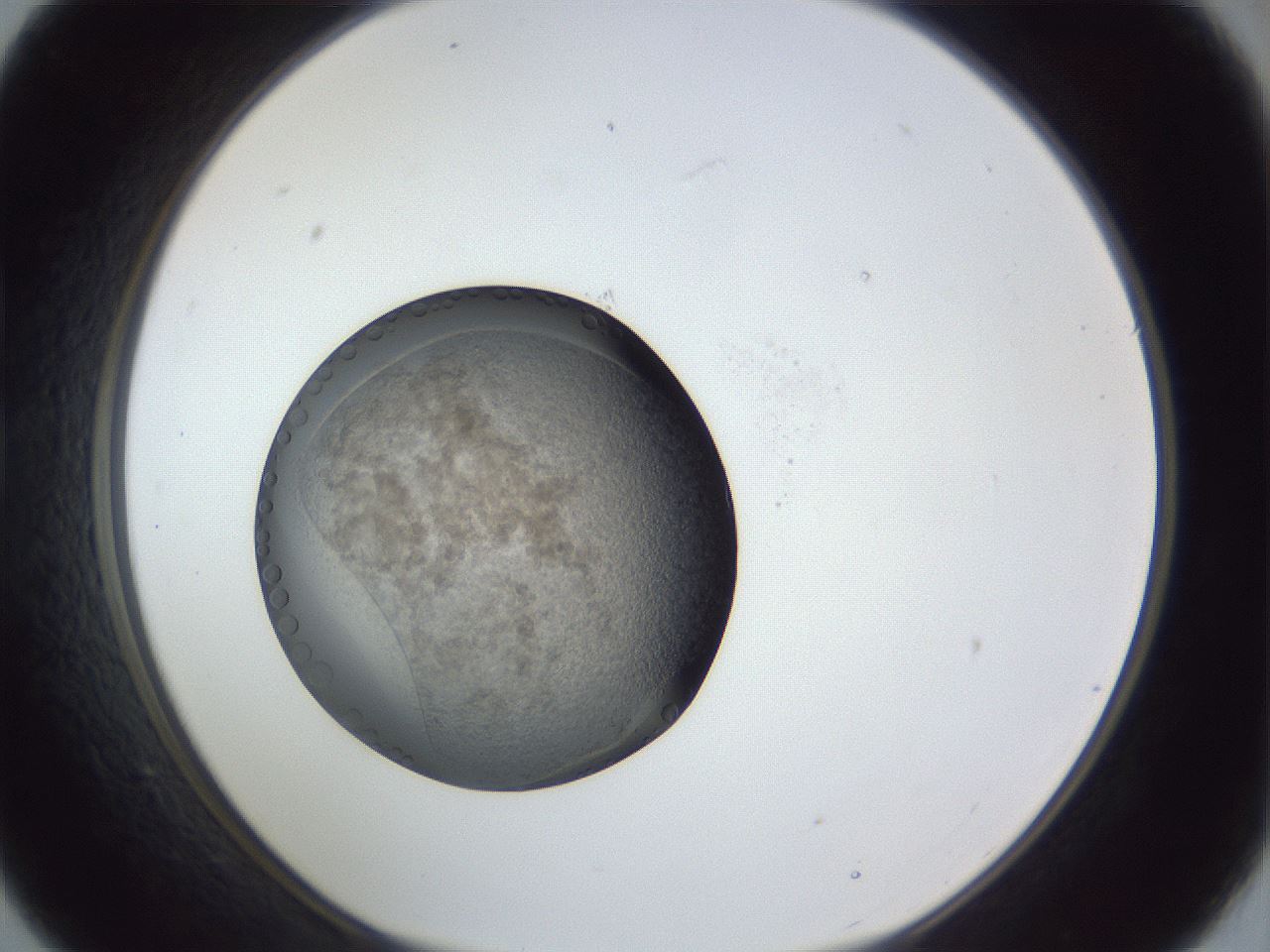 folderID944_plateID944_batchID1308_wellNum21_profileID1_d1_r35639_ef.jpg