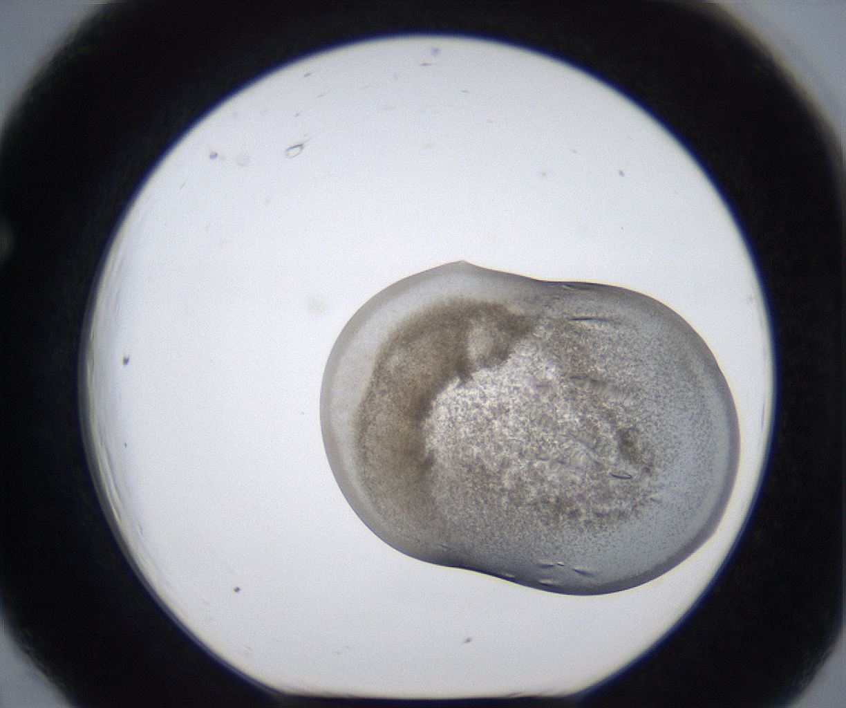 folderID268_plateID2268_batchID10957_wellNum66_profileID1_d1_r157700_ef.jpg