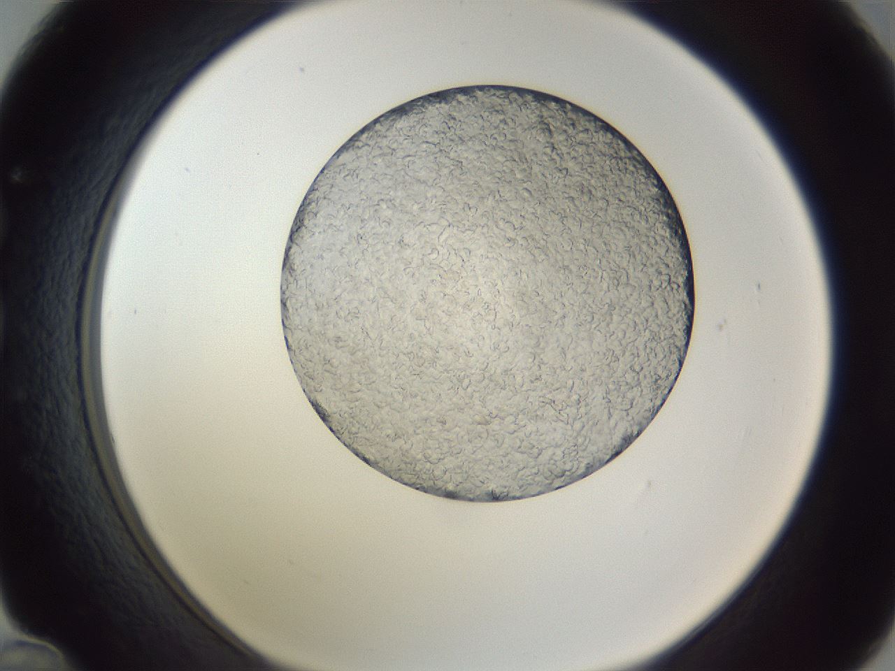 folderID345_plateID1345_batchID12314_wellNum36_profileID1_d1_r81006_ef.jpg