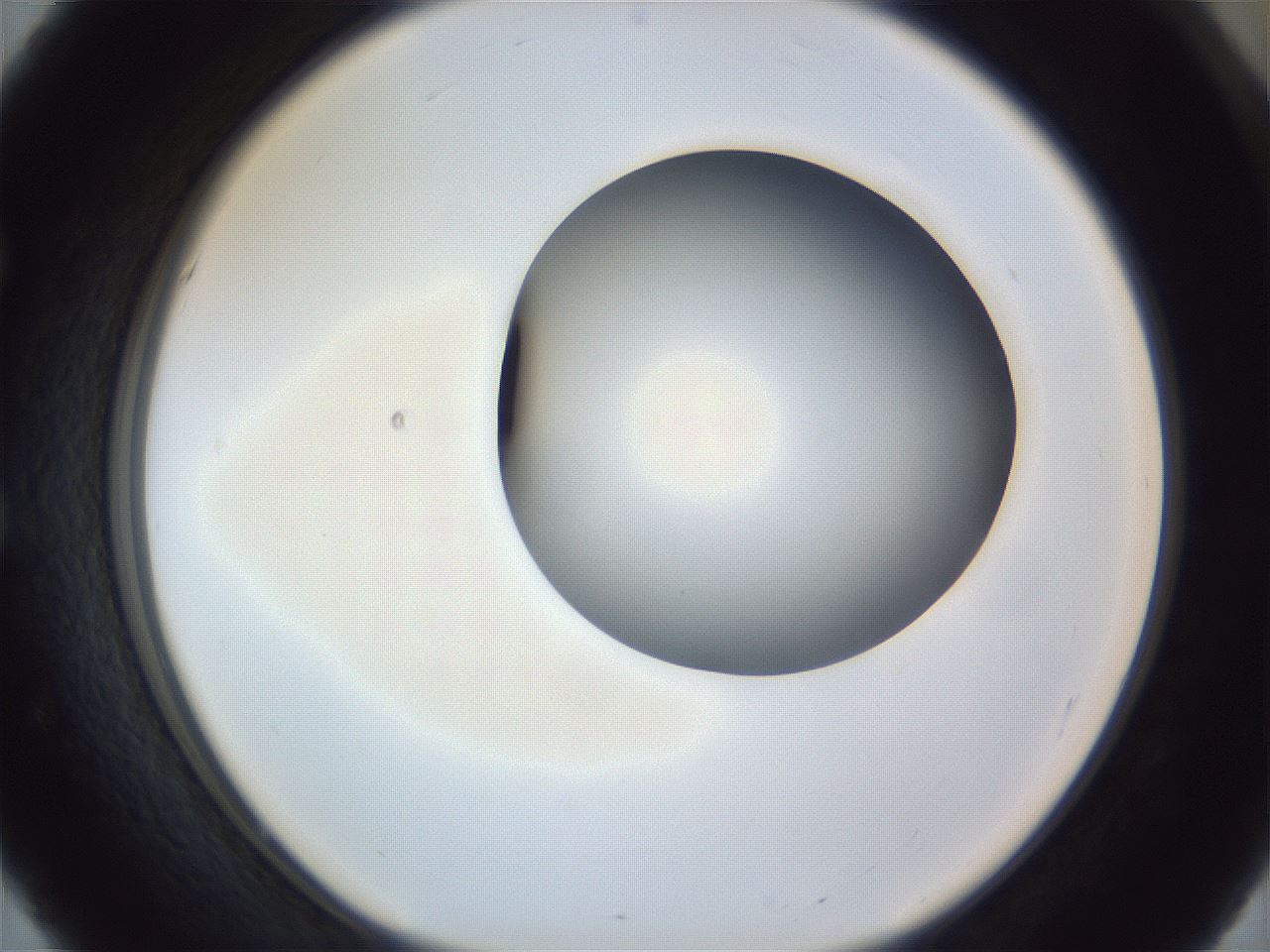 folderID161_plateID1161_batchID4079_wellNum51_profileID1_d1_r63299_ef.jpg