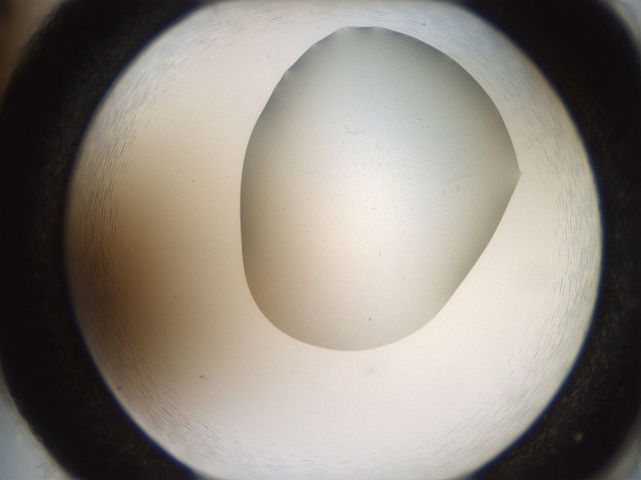 folderID205_plateID2205_batchID9800_wellNum86_profileID1_d2_r150114_ef.jpg