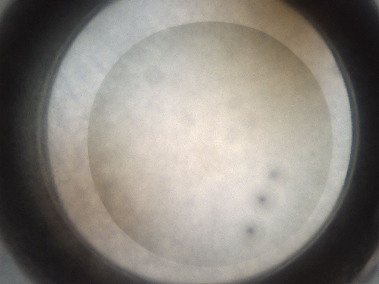 folderID22_plateID3022_batchID16584_wellNum55_profileID1_d2_r252400_ef.jpg