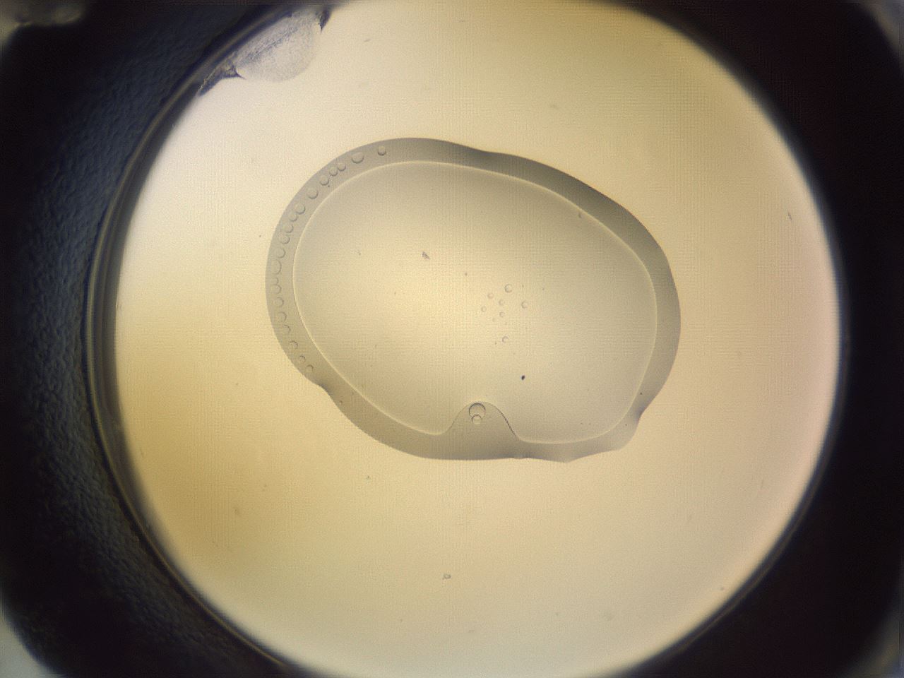 folderID268_plateID3268_batchID18598_wellNum72_profileID1_d2_r287070_ef.jpg