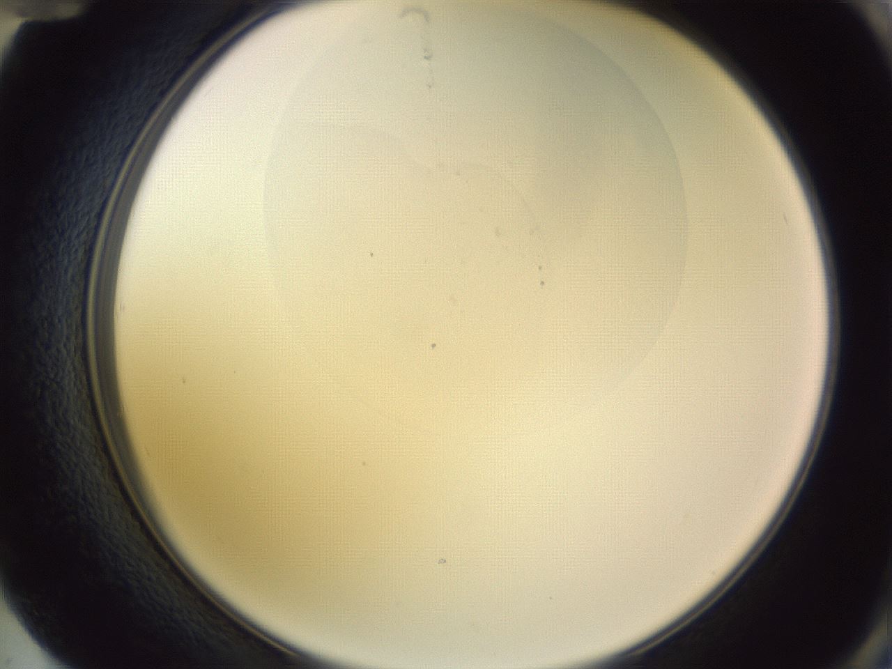 folderID277_plateID1277_batchID4876_wellNum72_profileID1_d2_r73671_ef.jpg