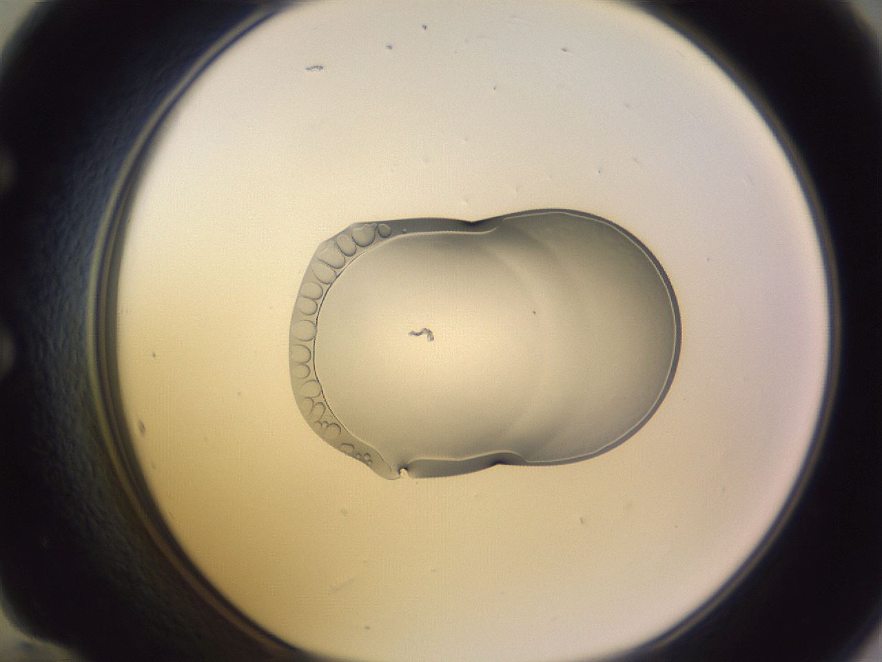 folderID281_plateID1281_batchID3949_wellNum60_profileID1_d1_r75950_ef.jpg