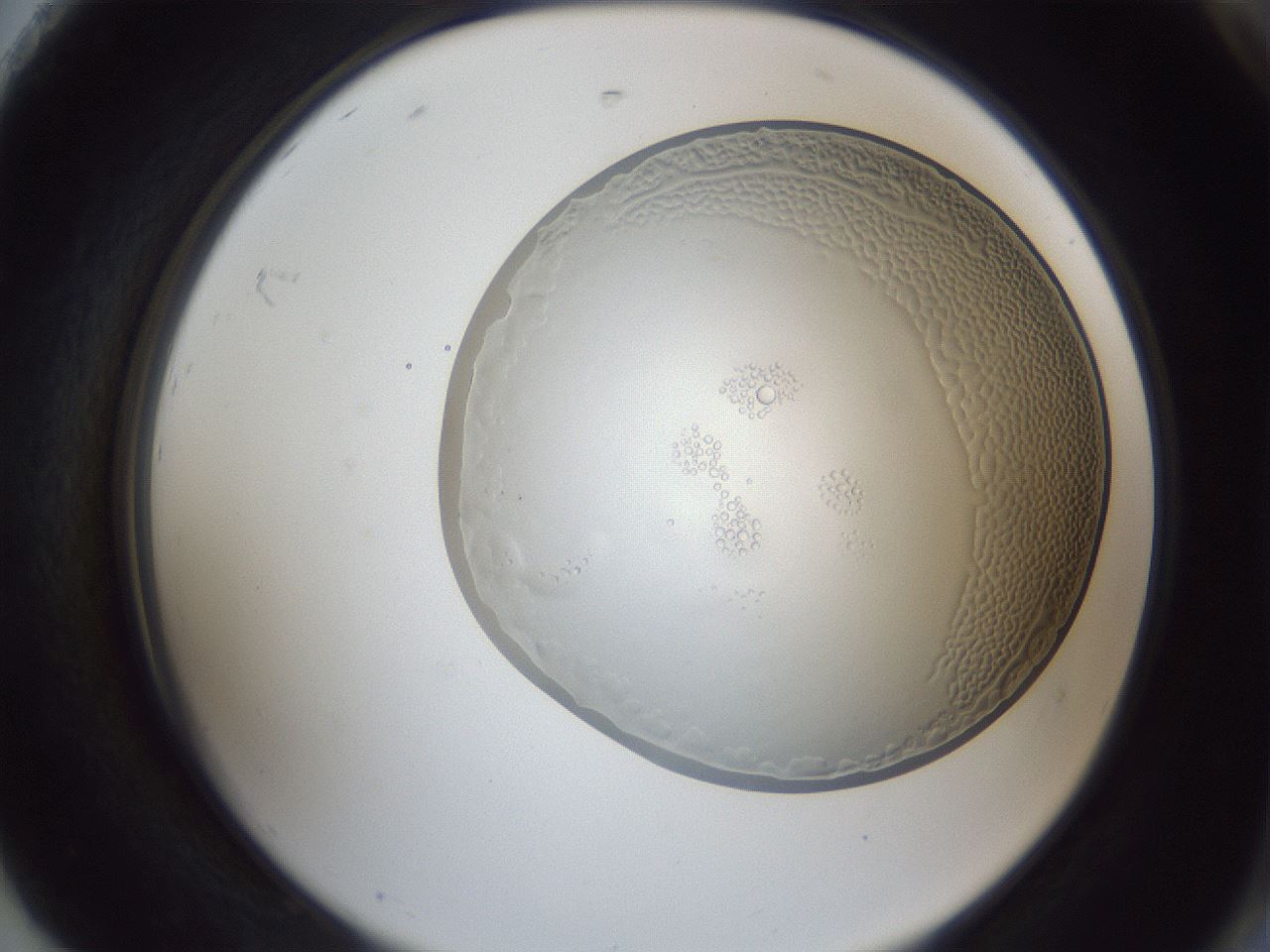 folderID165_plateID1165_batchID2855_wellNum92_profileID1_d2_r61270_ef.jpg