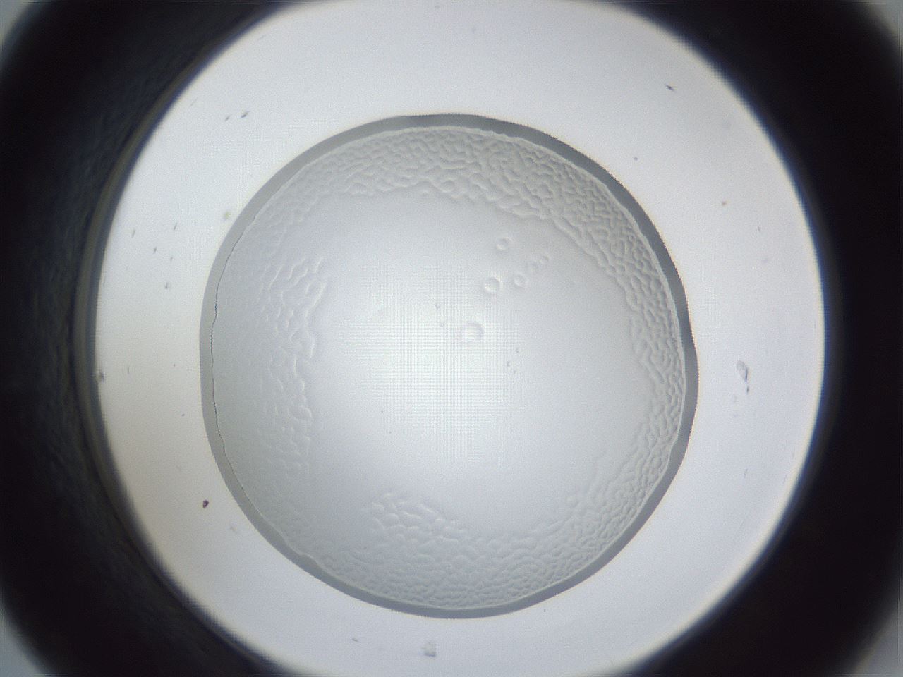 folderID165_plateID1165_batchID2920_wellNum31_profileID1_d2_r61148_ef.jpg