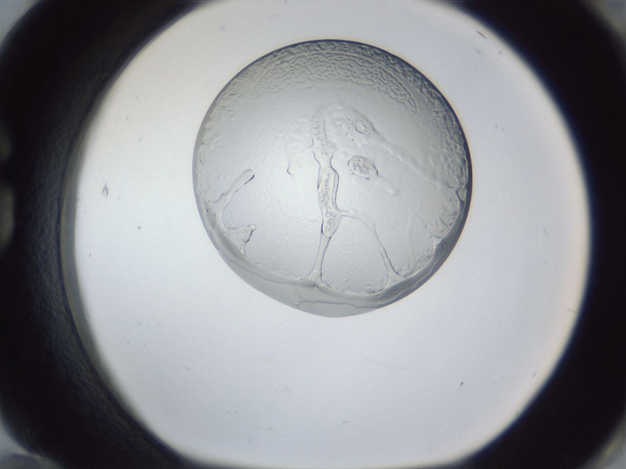 folderID166_plateID1166_batchID3004_wellNum84_profileID1_d1_r61445_ef.jpg