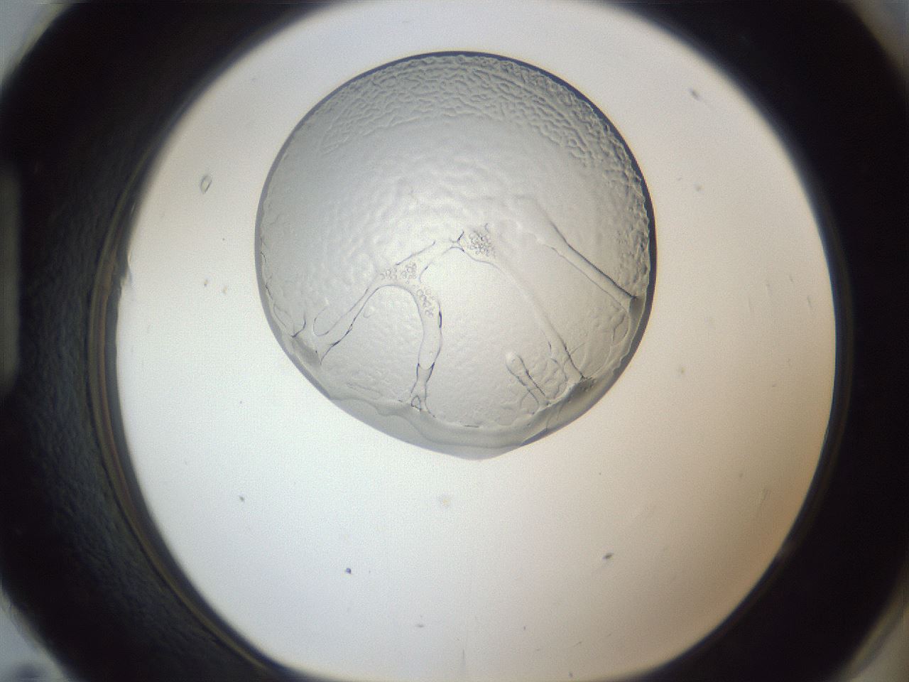 folderID166_plateID1166_batchID3283_wellNum95_profileID1_d1_r61467_ef.jpg