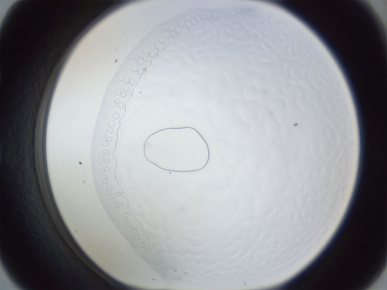 folderID167_plateID1167_batchID2961_wellNum57_profileID1_d1_r61583_ef.jpg