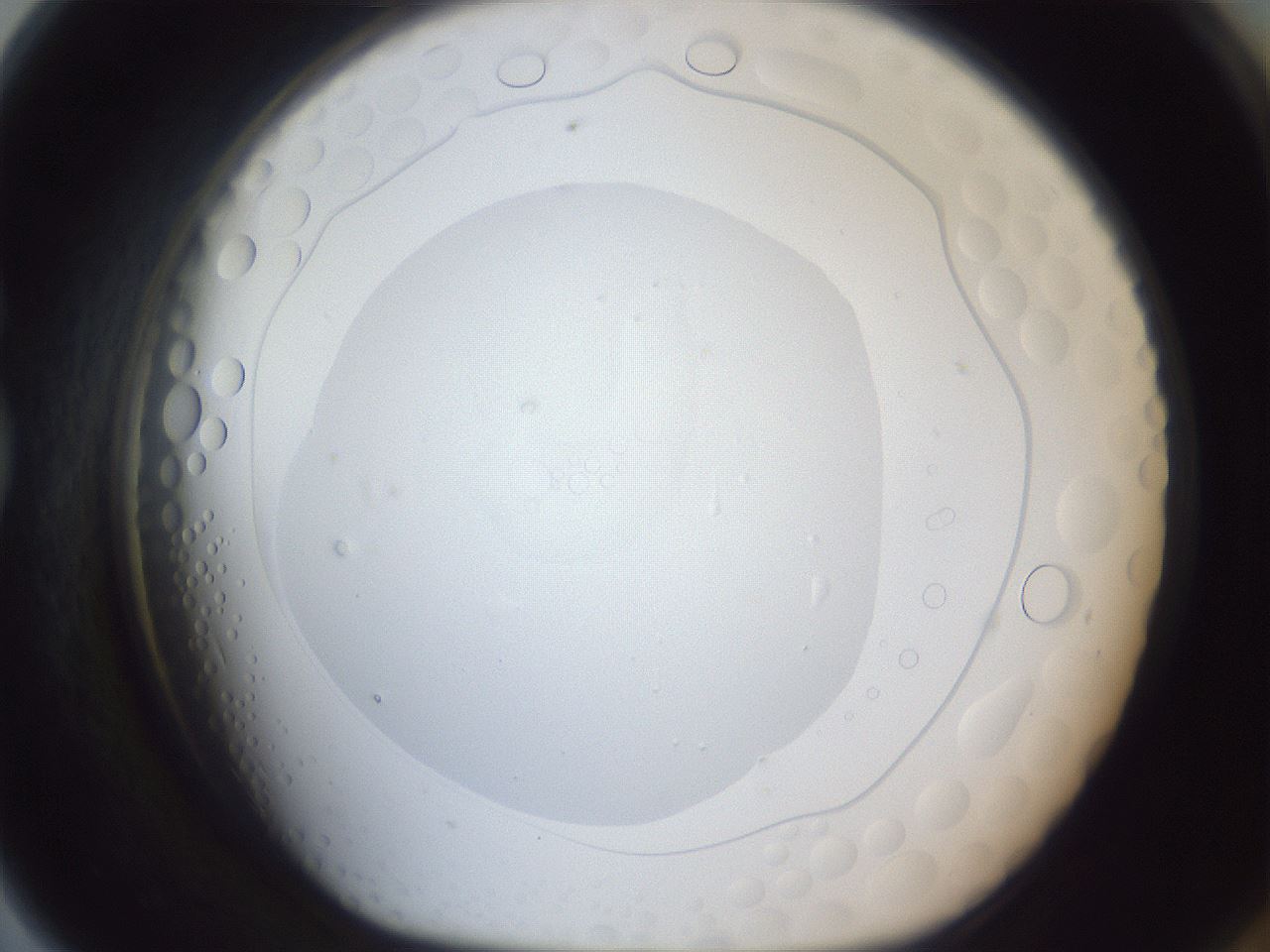 folderID167_plateID1167_batchID3005_wellNum79_profileID1_d1_r61627_ef.jpg