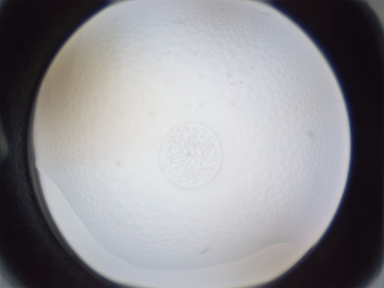 folderID167_plateID1167_batchID3018_wellNum6_profileID1_d1_r61481_ef.jpg