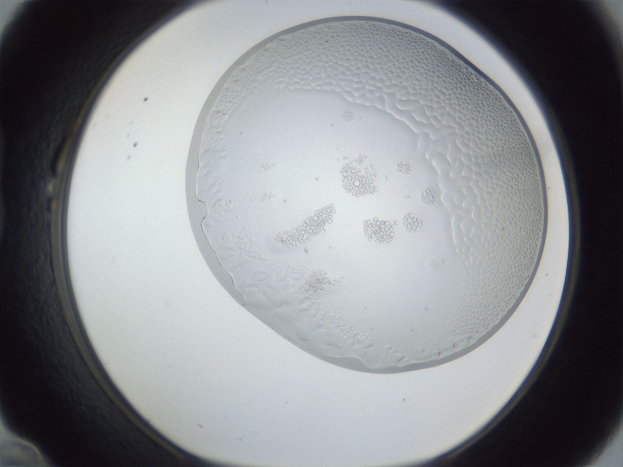 folderID205_plateID1205_batchID3572_wellNum22_profileID1_d1_r66794_ef.jpg