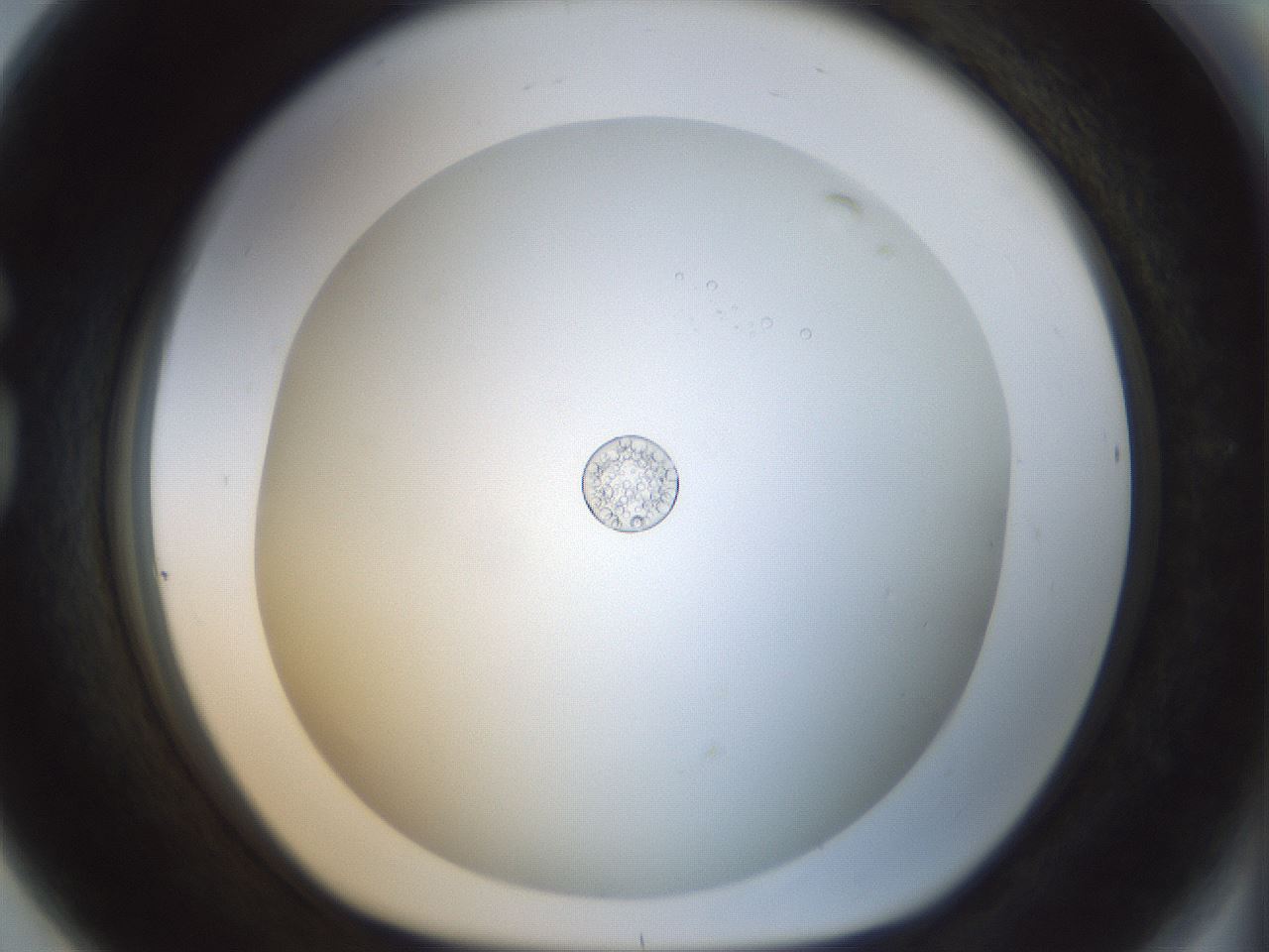 folderID209_plateID1209_batchID3598_wellNum80_profileID1_d1_r69310_ef.jpg