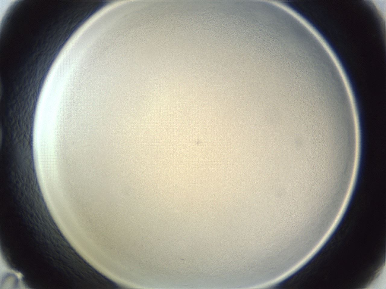 folderID216_plateID1216_batchID4655_wellNum35_profileID1_d1_r68164_ef.jpg
