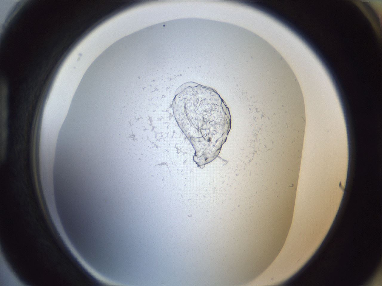 folderID217_plateID1217_batchID3562_wellNum88_profileID1_d1_r68942_ef.jpg