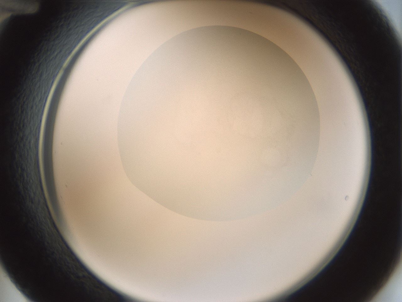 folderID251_plateID3251_batchID18293_wellNum48_profileID1_d2_r286242_ef.jpg