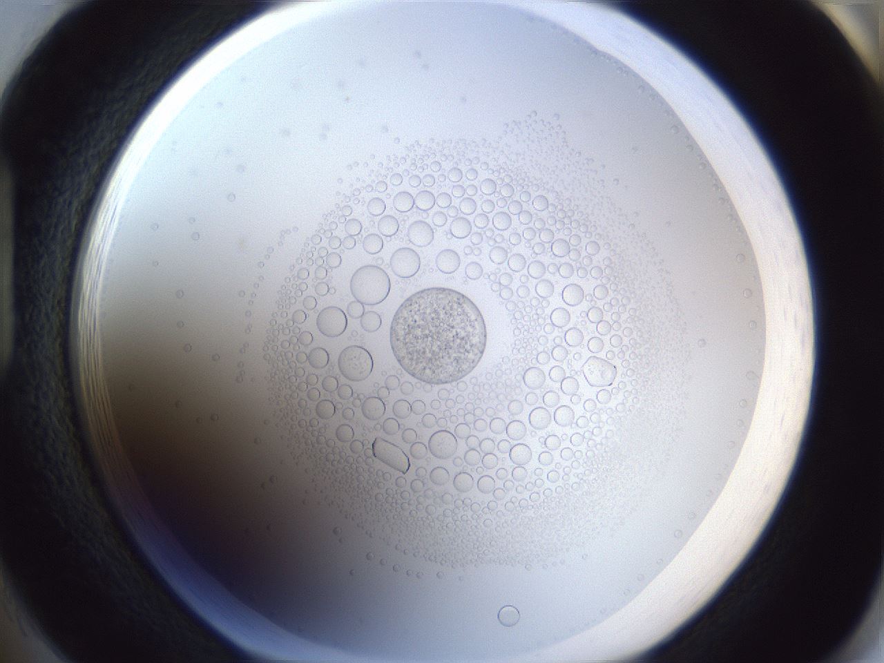 folderID215_plateID1215_batchID3377_wellNum85_profileID1_d1_r67304_ef.jpg