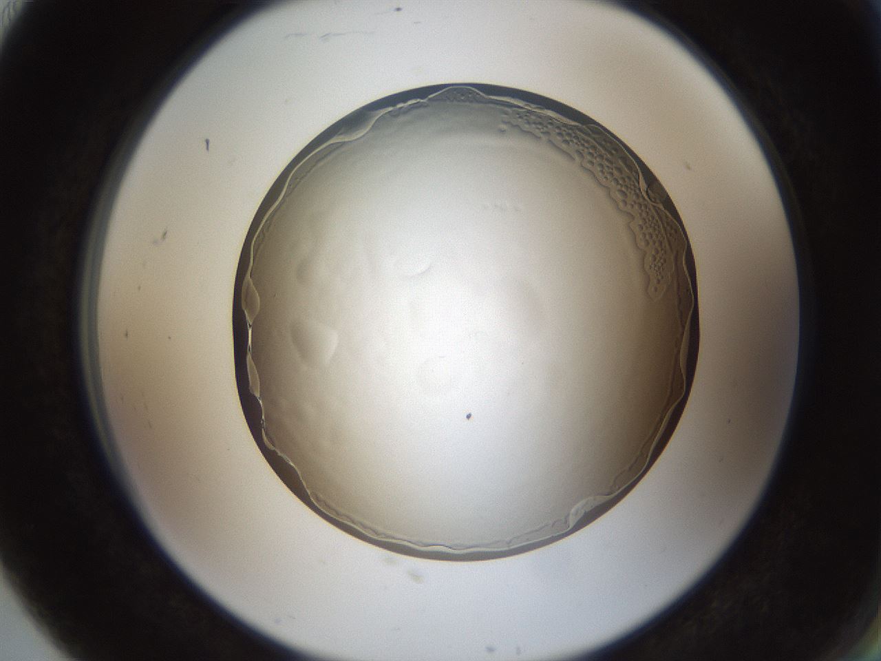 folderID206_plateID1206_batchID4224_wellNum91_profileID1_d2_r67125_ef.jpg