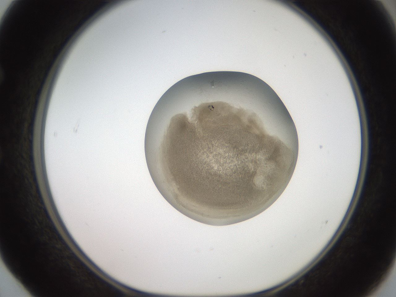 folderID20_plateID3020_batchID16541_wellNum52_profileID1_d1_r252201_ef.jpg