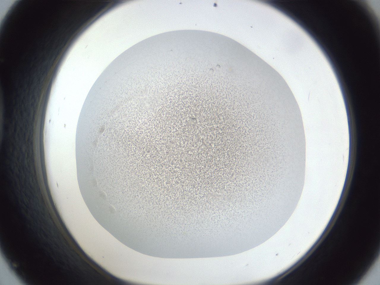 folderID28_plateID1028_batchID2091_wellNum45_profileID1_d1_r44028_ef.jpg