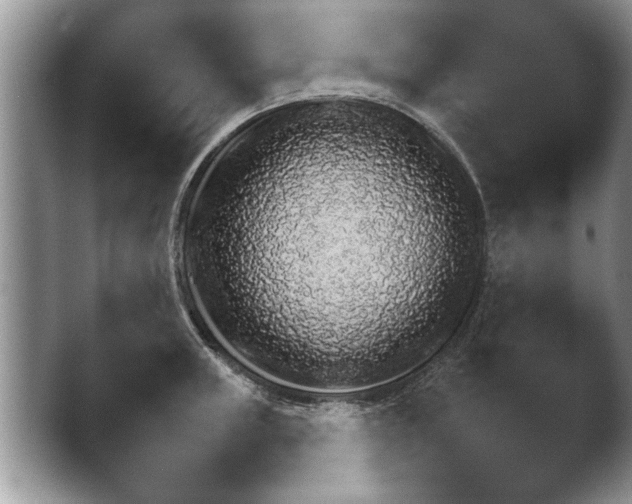X0000048251235200503171814.png
