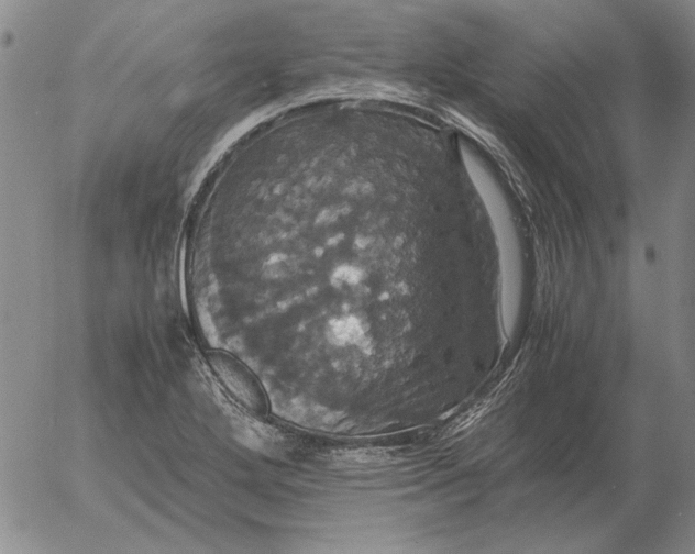 X0000054171272200508101750.png