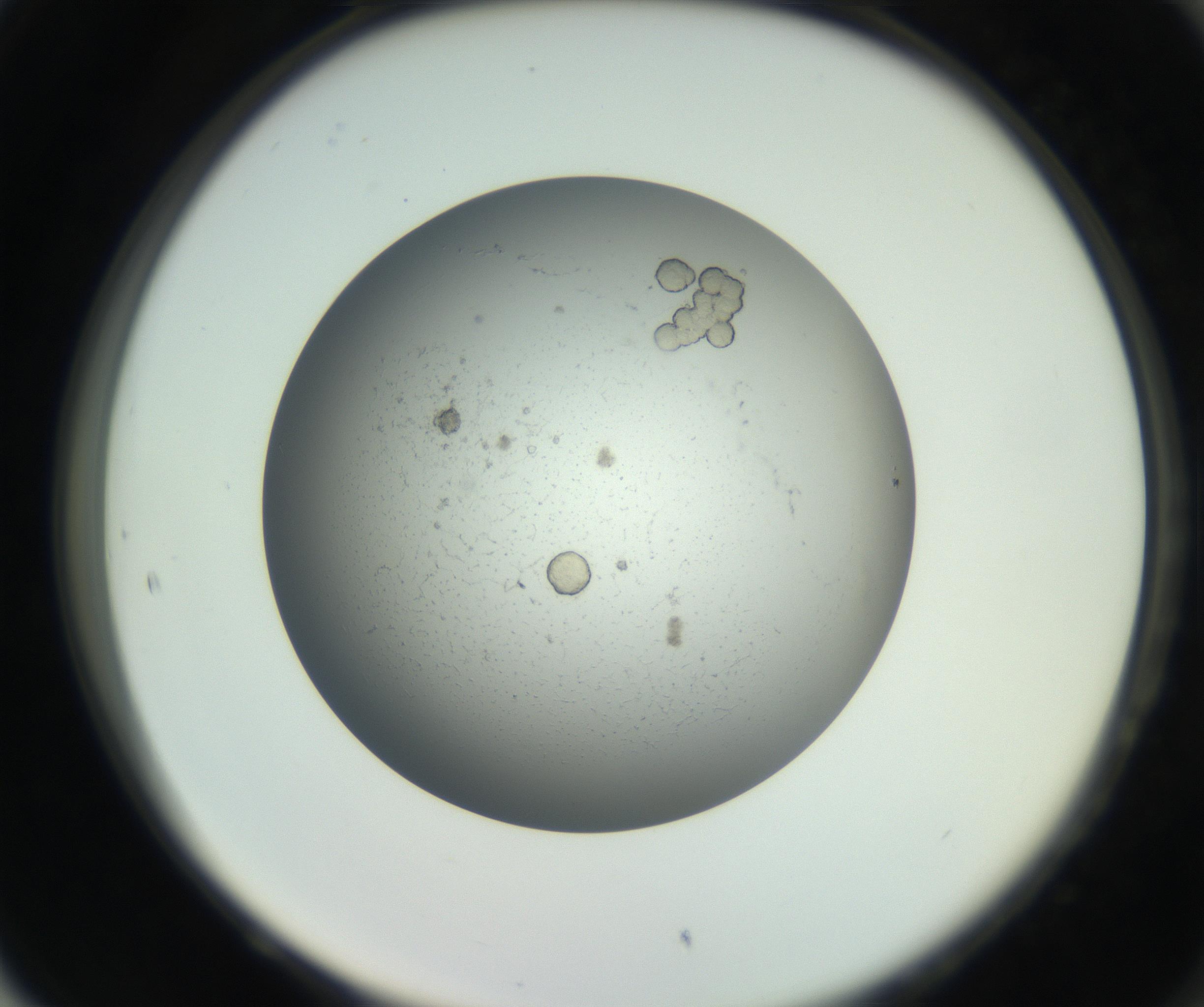 RI01_03_000_0212_Proj1_Clon1_MC_0000MC011202_010_160915_05_08_02_00_99_002_001_RAI.jpg