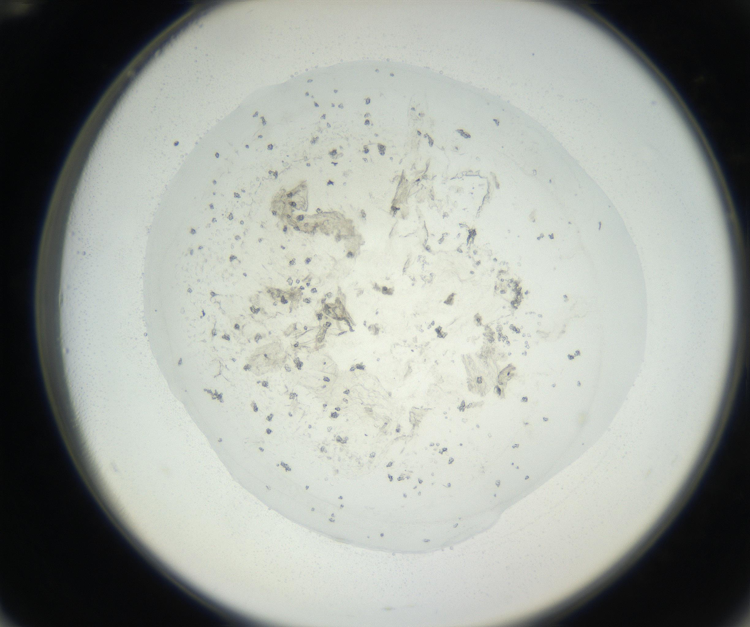 RI01_03_000_0212_Proj1_Clon1_MC_0000MC102627_003_160812_12_05_02_00_99_002_001_RAI.jpg