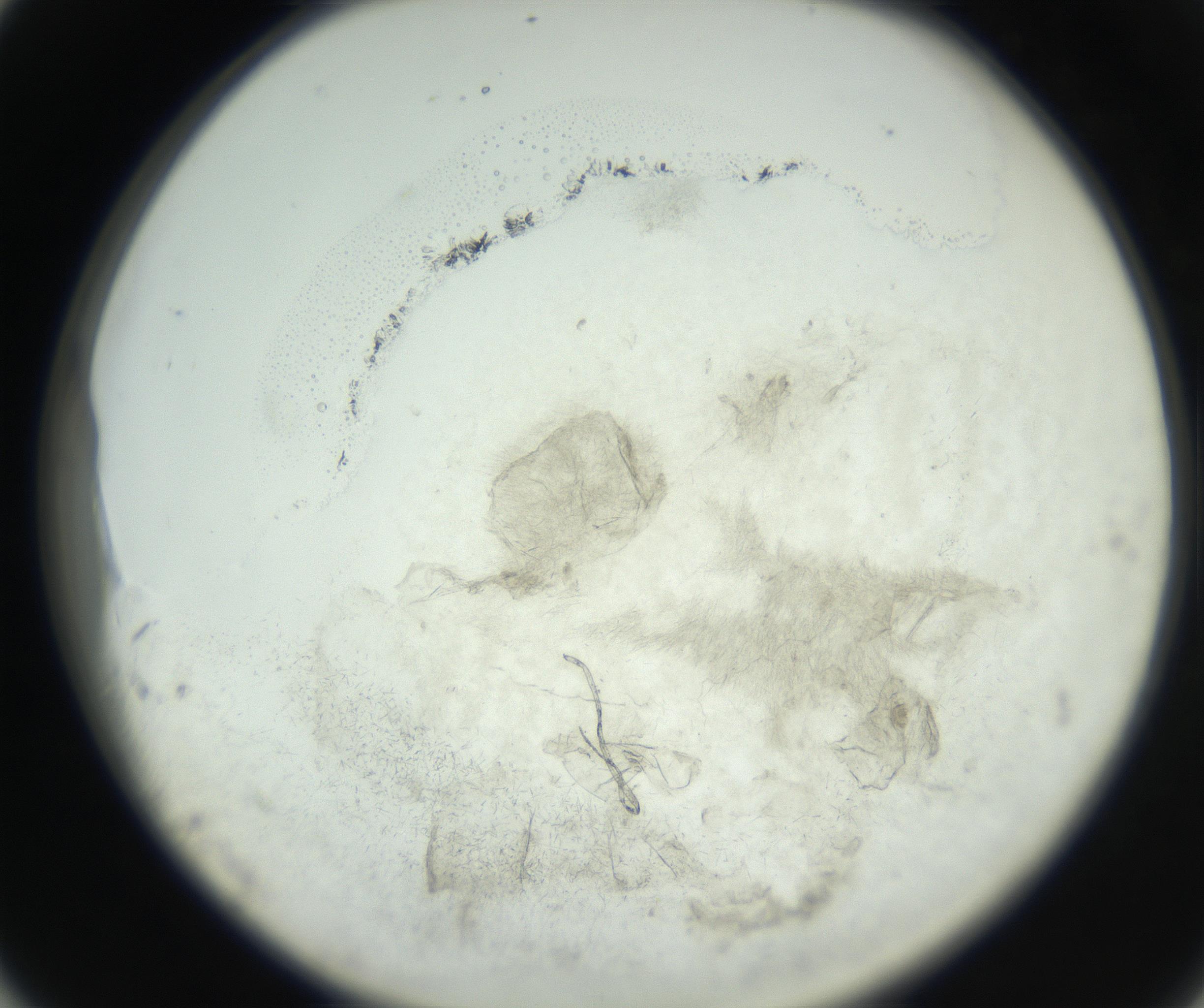 RI01_03_000_0212_Proj1_Clon1_MC_0000MC102627_008_160830_04_04_02_00_99_002_001_RAI.jpg