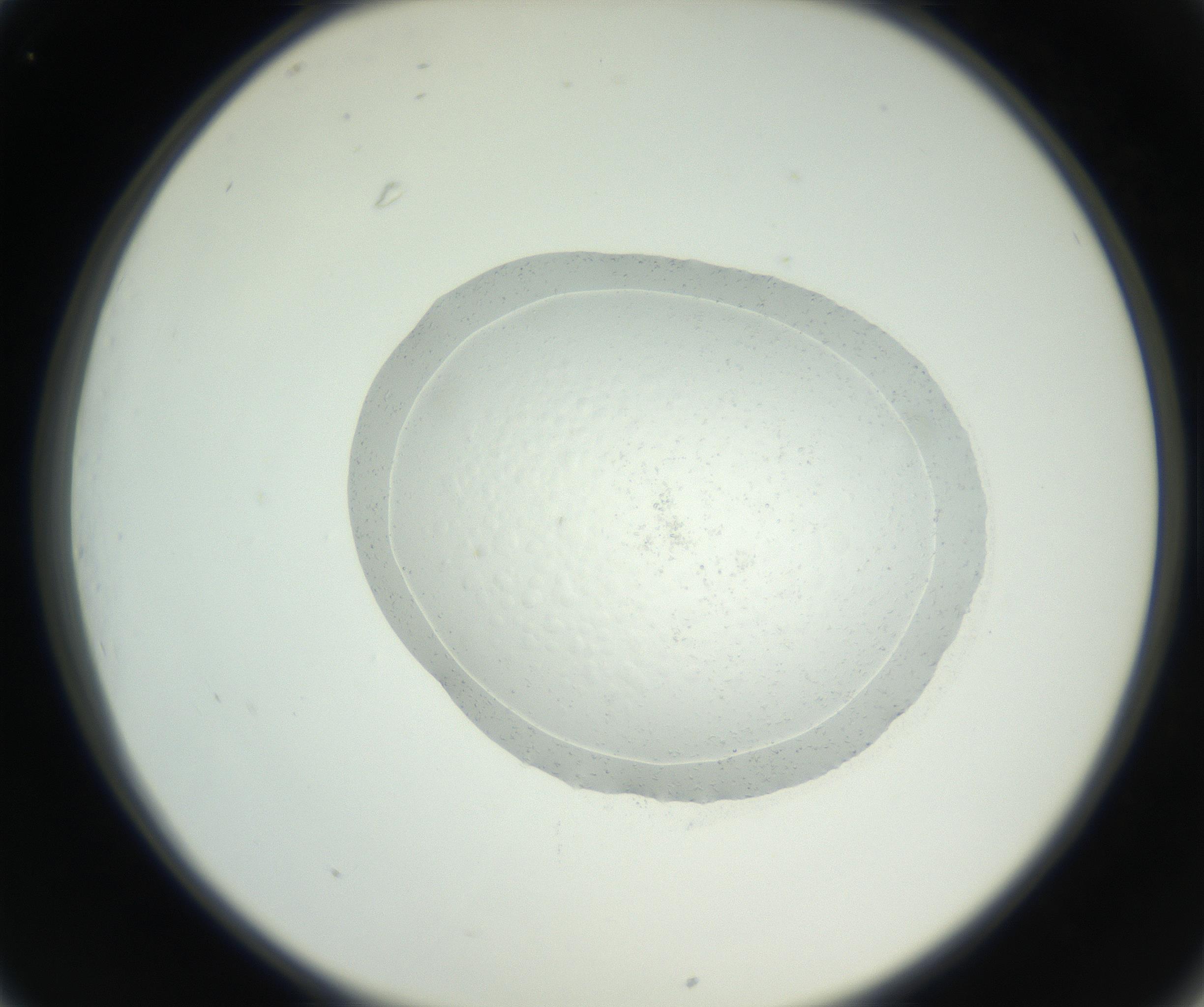 RI01_03_000_0212_Proj1_Clon1_MC_0000MC102667_004_160828_01_03_02_00_99_002_001_RAI.jpg